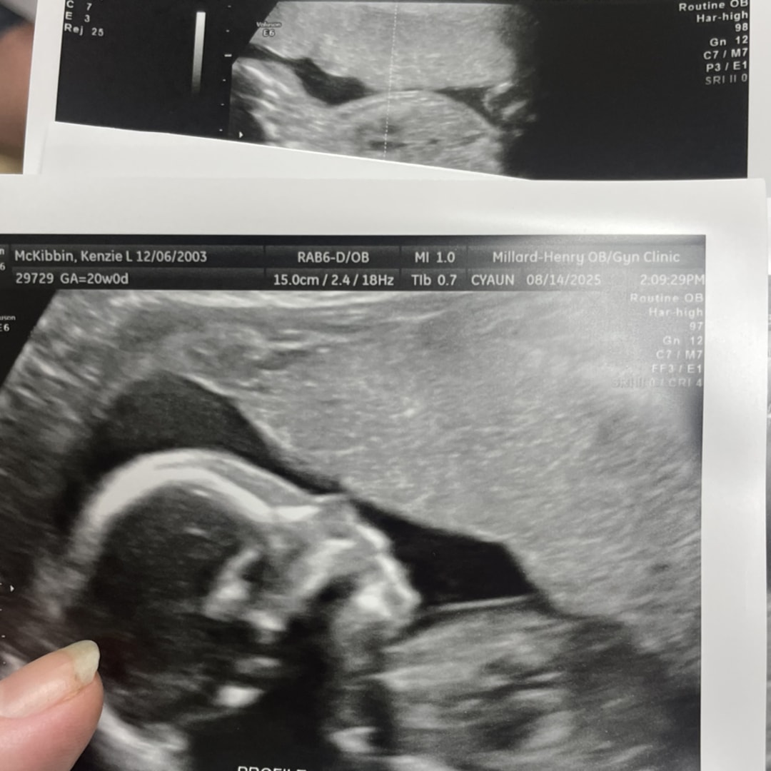 Photo shared by Kenzie for their Babylist baby registry.