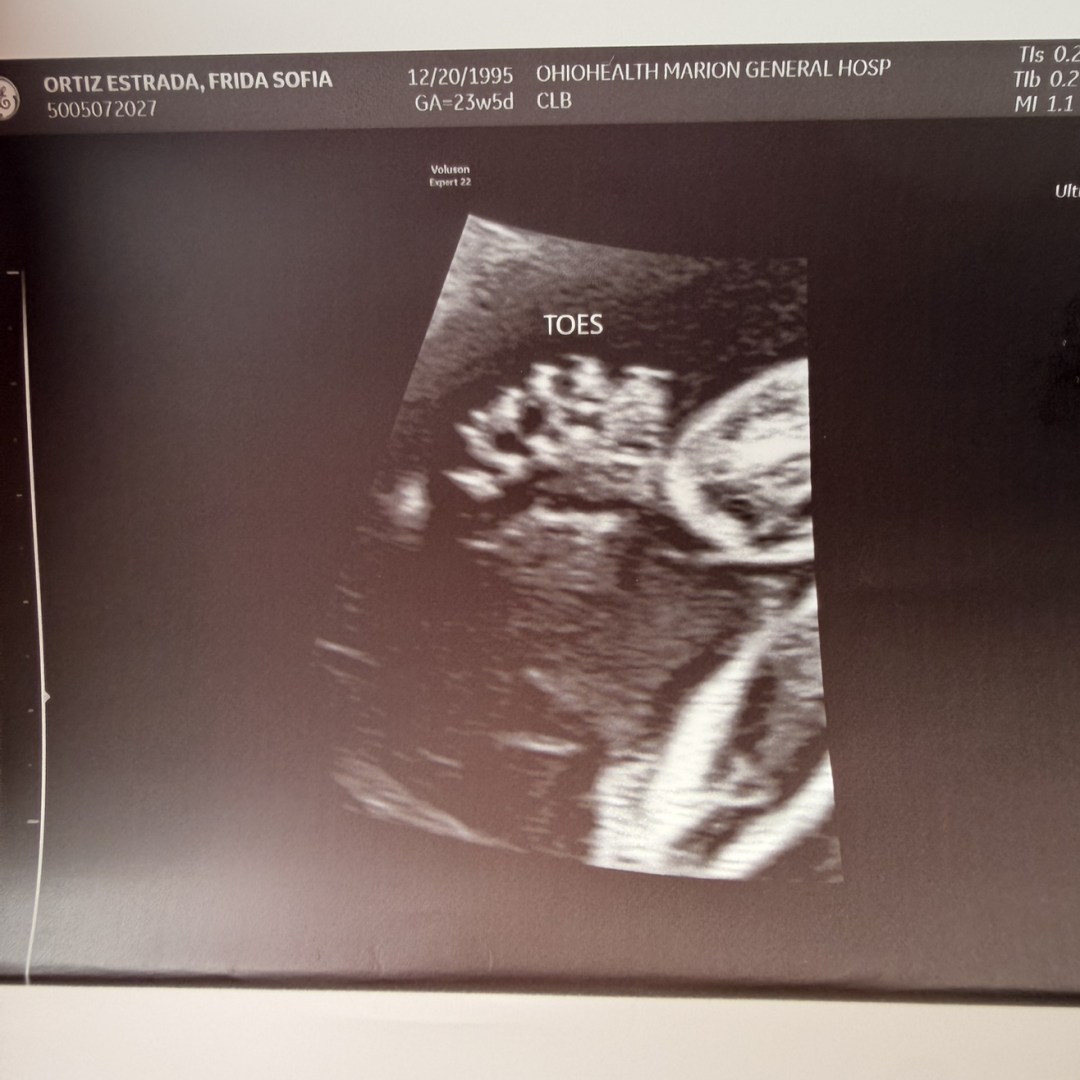 Photo shared by Frida for their Babylist baby registry.