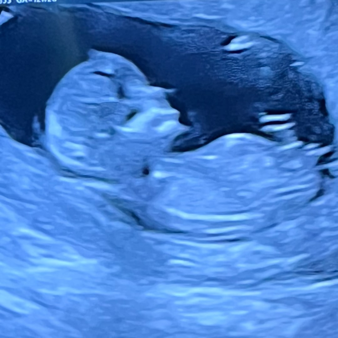 Photo shared by Angelique for their Babylist baby registry.