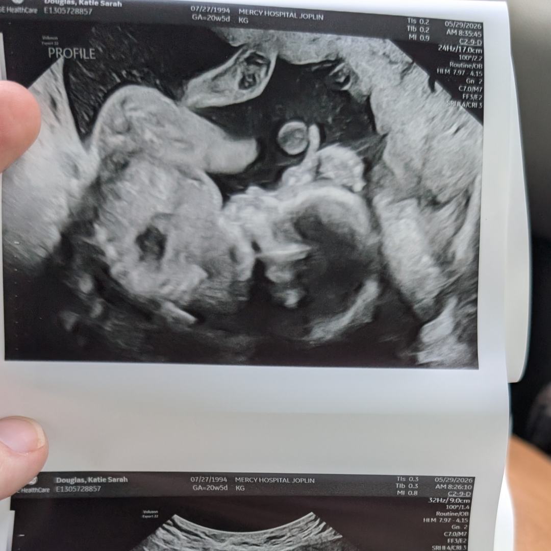 Photo shared by Katie for their Babylist baby registry.