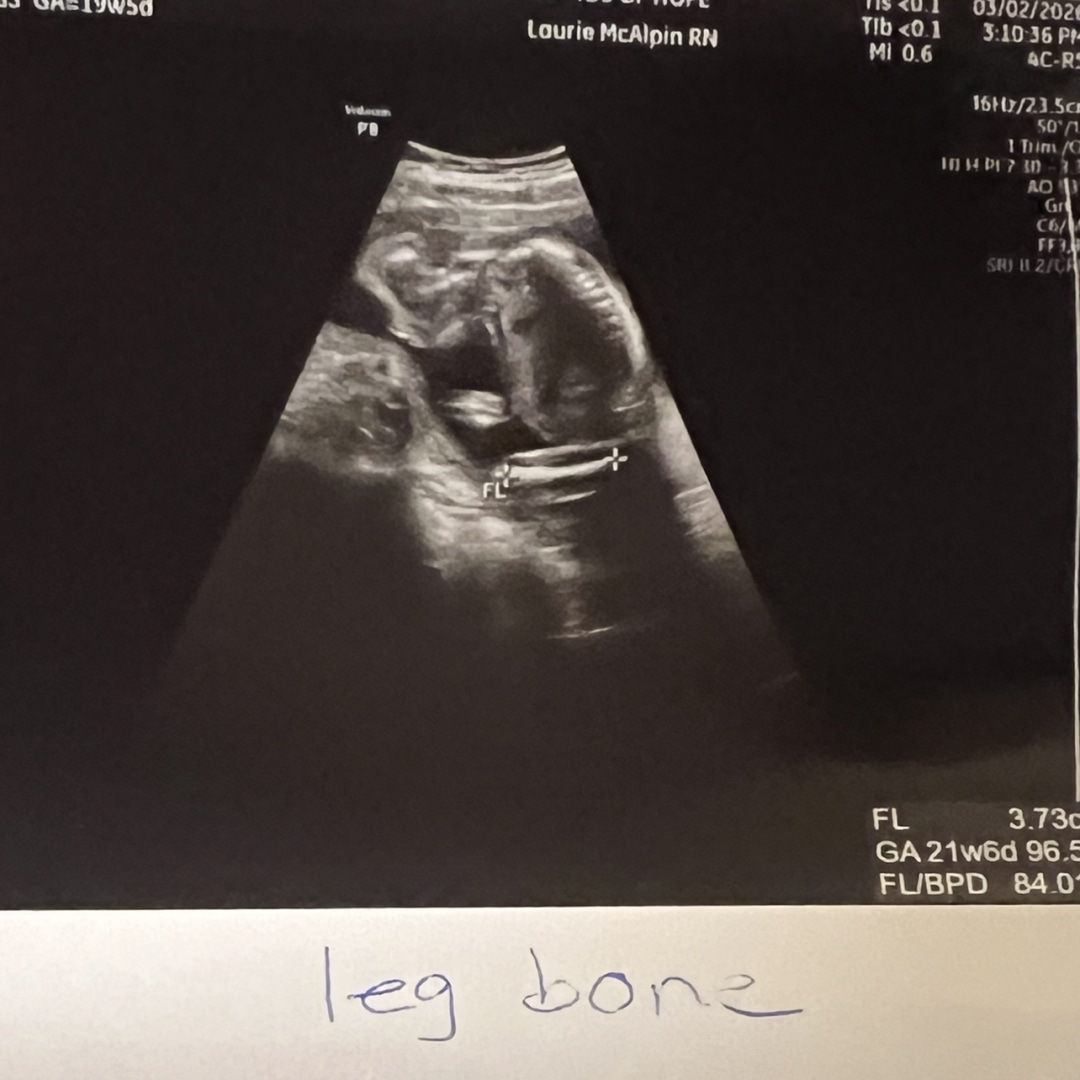 Photo shared by Trinity for their Babylist baby registry.