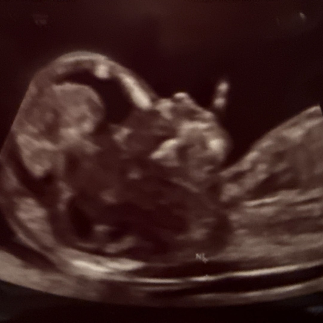 Photo shared by Danya for their Babylist baby registry.