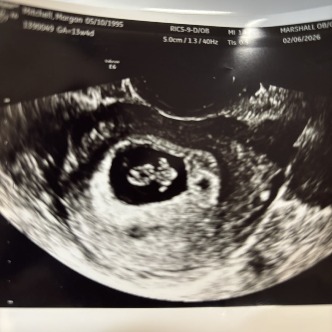 Photo shared by Morgan for their Babylist baby registry.