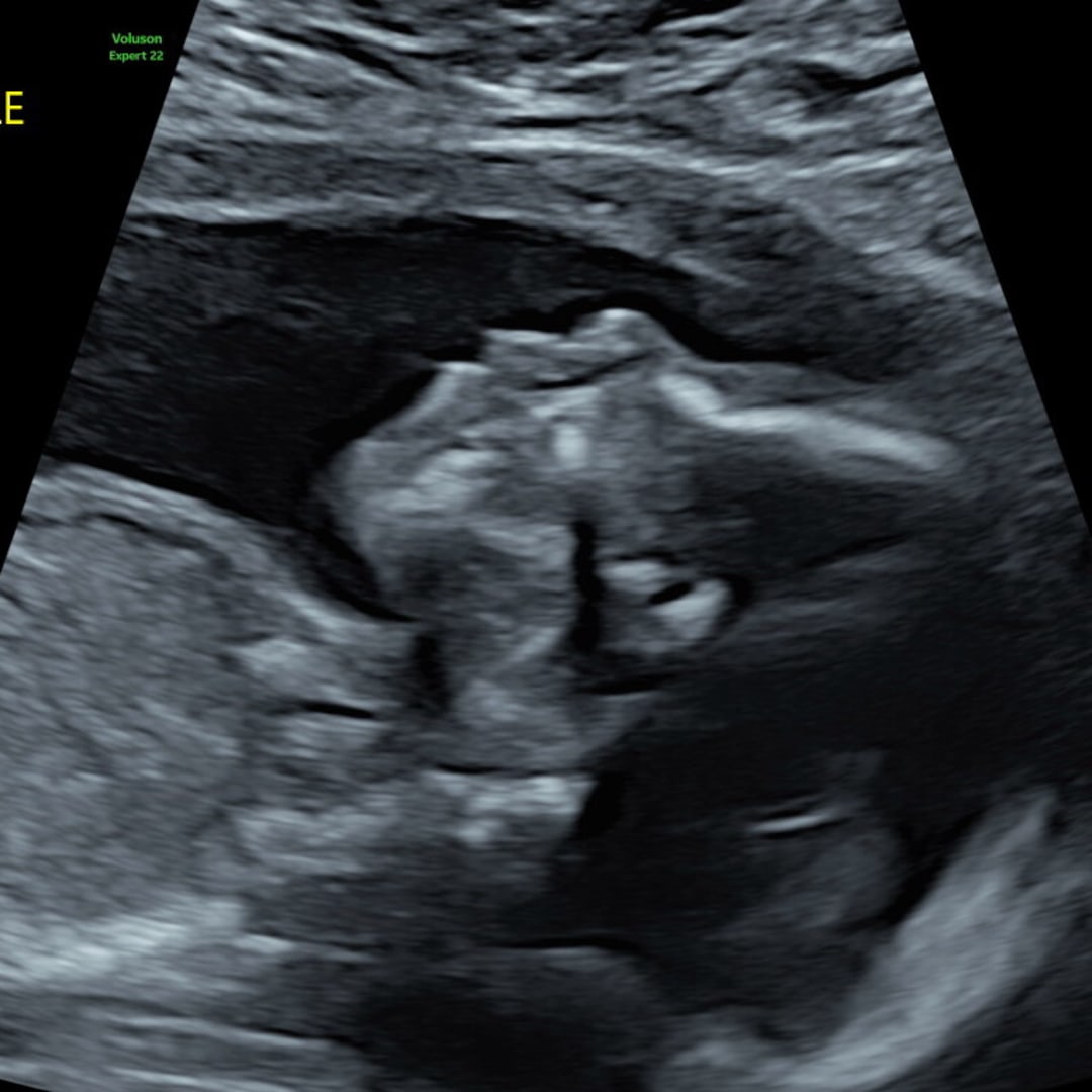Photo shared by Aline for their Babylist baby registry.