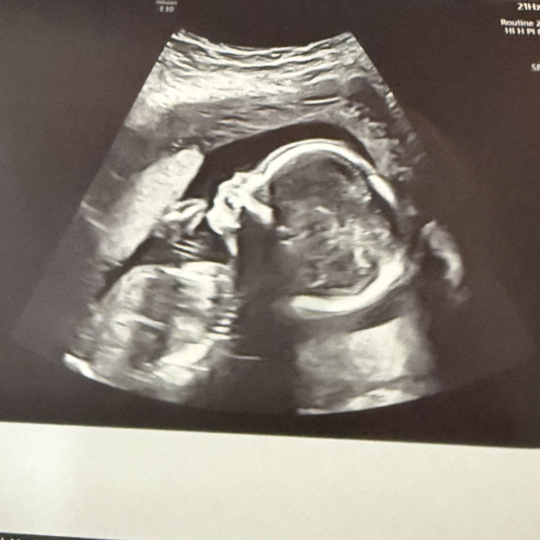 Photo shared by Martha for their Babylist baby registry.