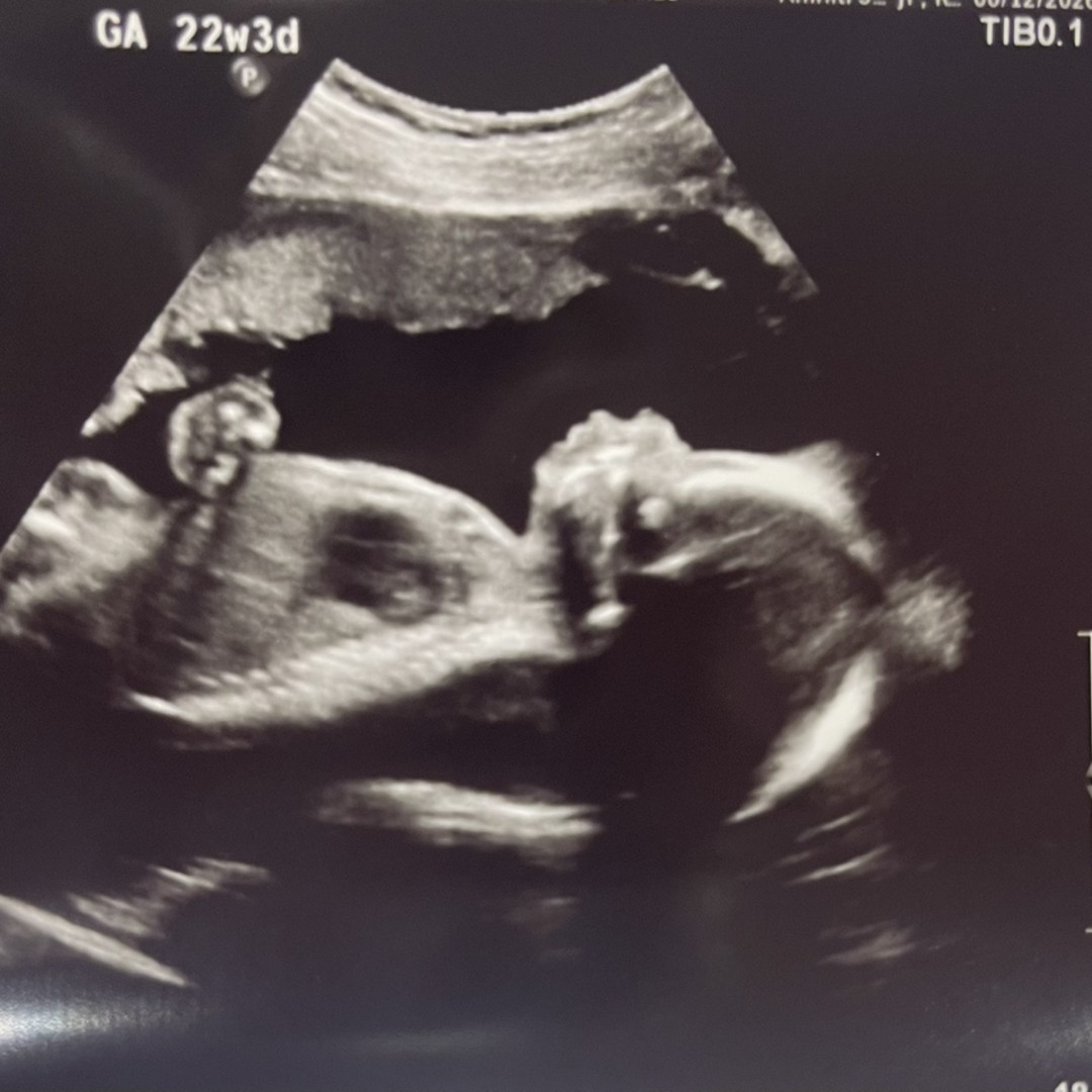 Photo shared by Kaitlyn for their Babylist baby registry.