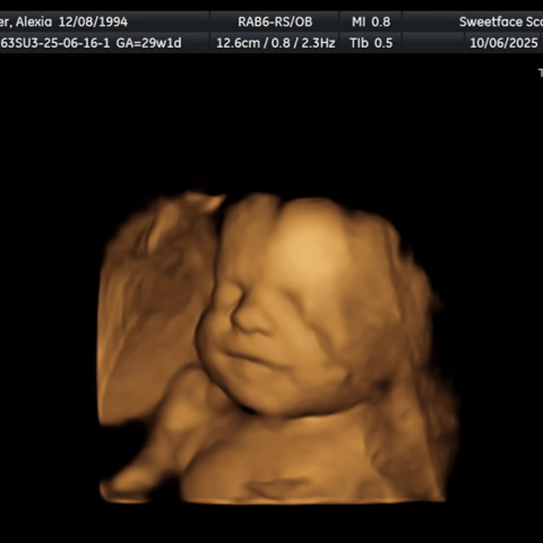 Photo shared by Alexia for their Babylist baby registry.