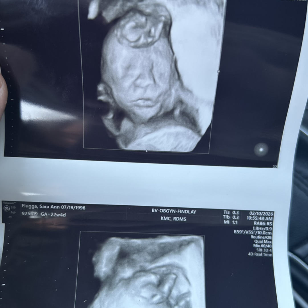 Photo shared by Sara for their Babylist baby registry.