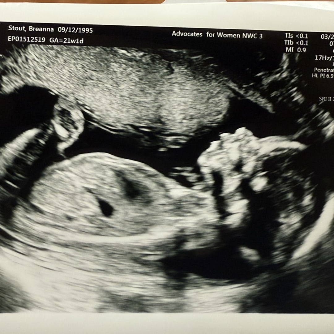 Photo shared by Breanna for their Babylist baby registry.