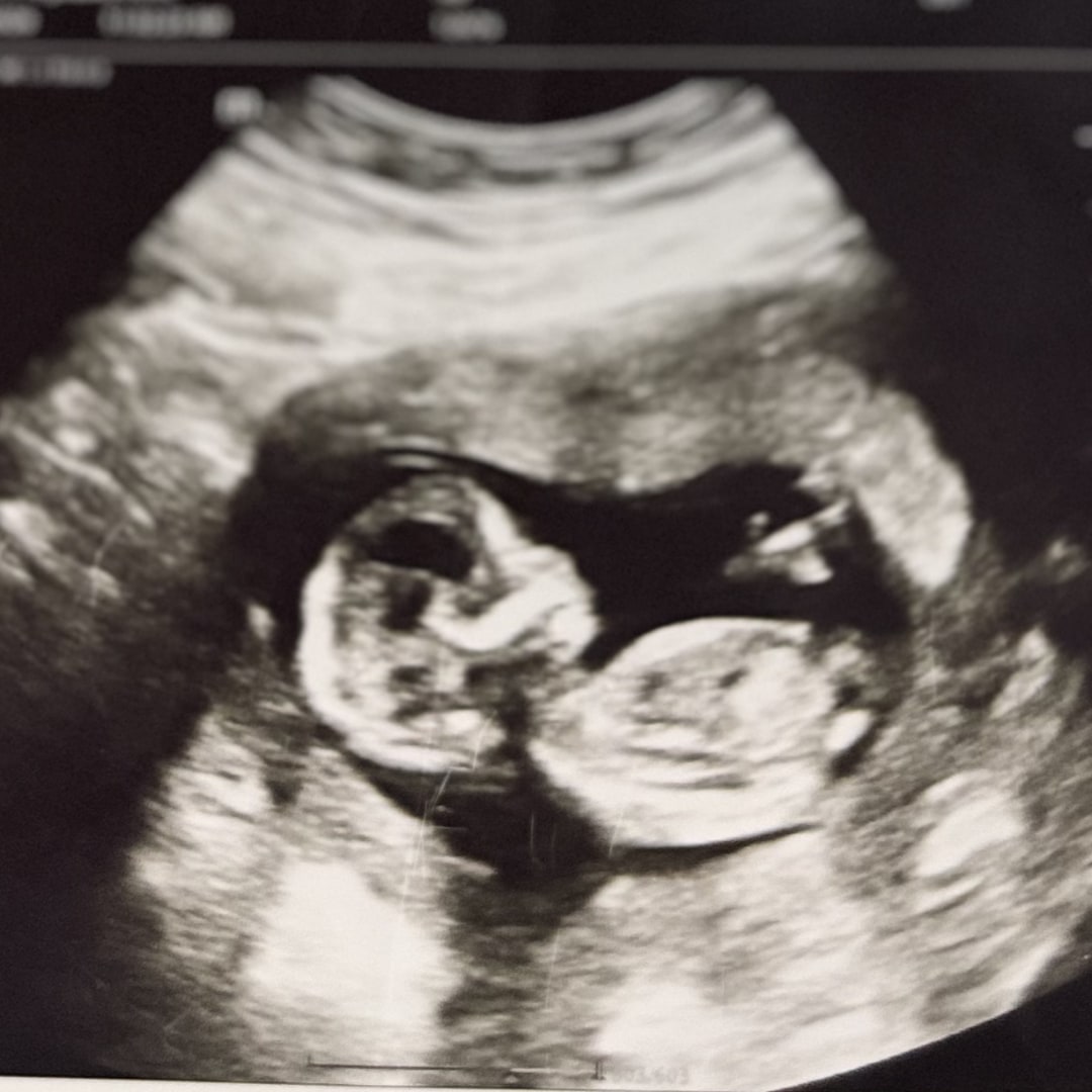 Photo shared by Angelicas for their Babylist baby registry.