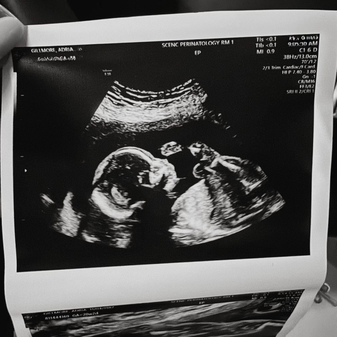 Photo shared by Adria for their Babylist baby registry.