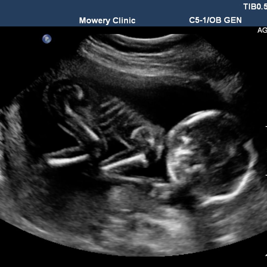 Photo shared by Krista for their Babylist baby registry.