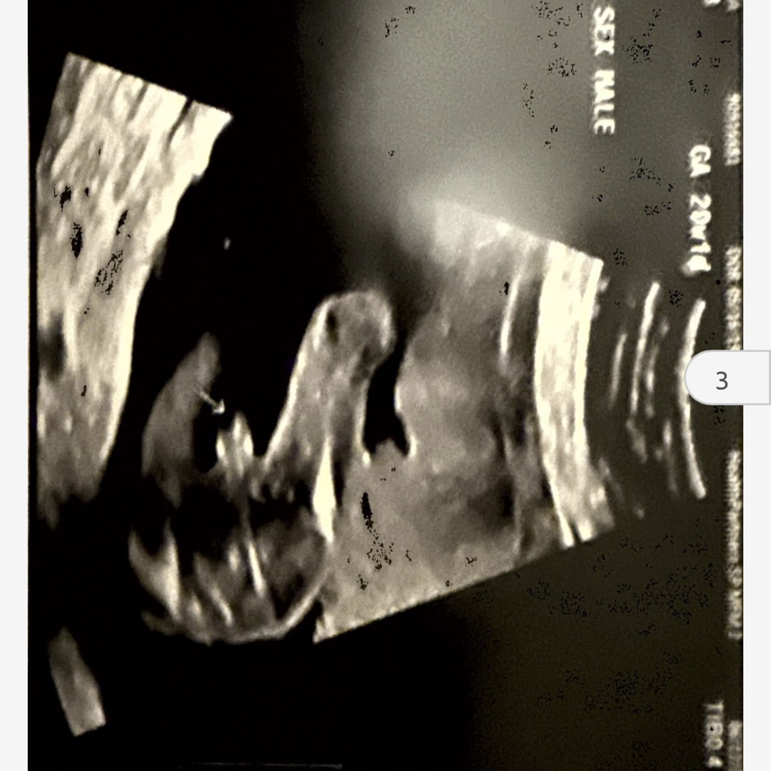 Photo shared by Chantra for their Babylist baby registry.