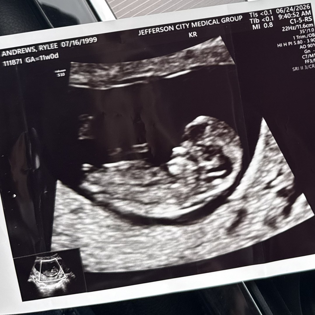 Photo shared by Rylee for their Babylist baby registry.
