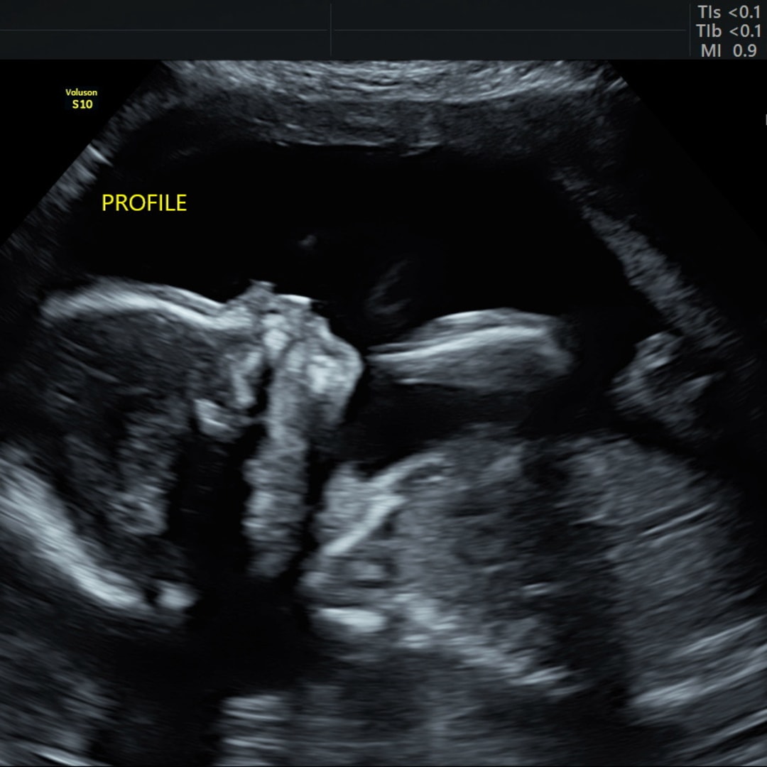 Photo shared by Melissa for their Babylist baby registry.