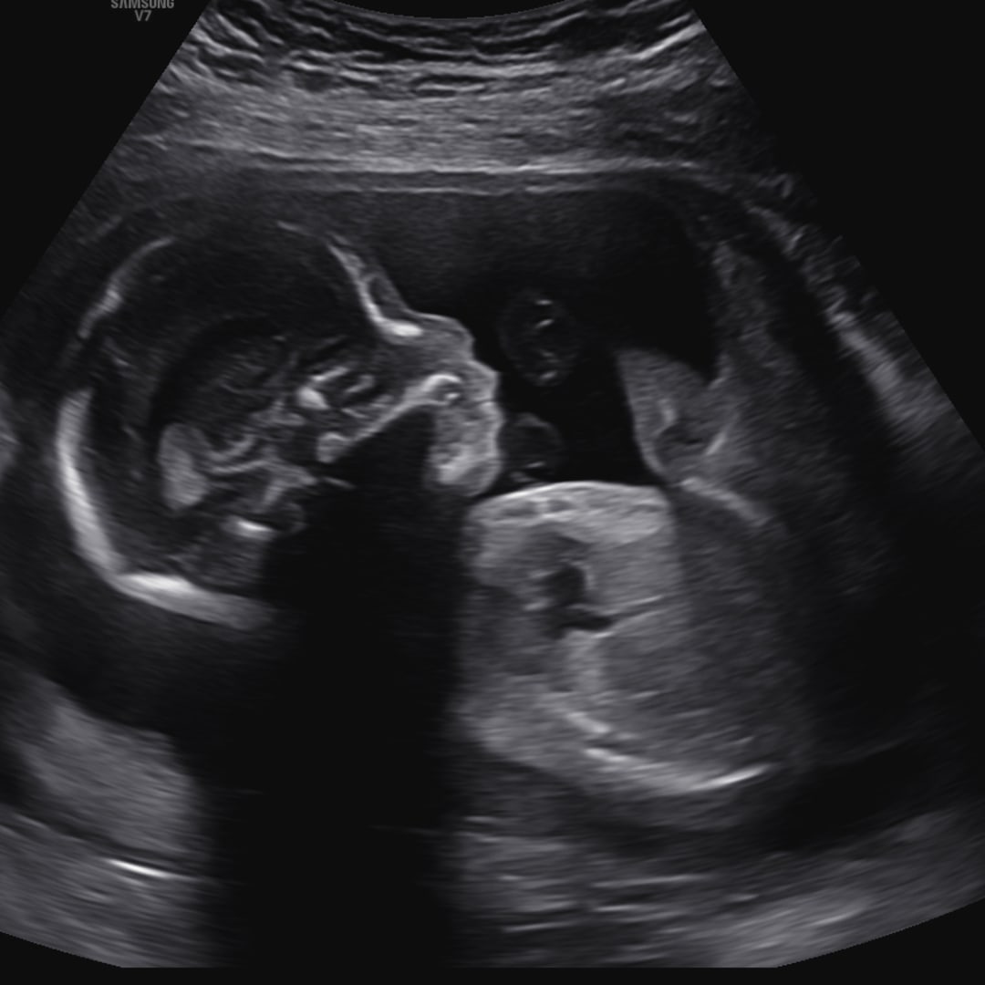 Photo shared by Leia for their Babylist baby registry.