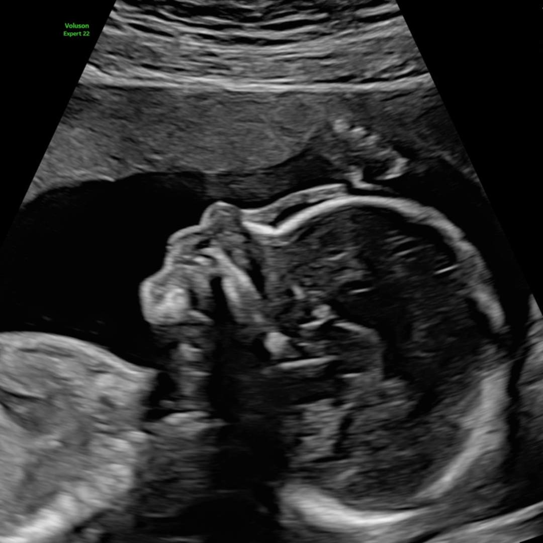 Photo shared by Kayla for their Babylist baby registry.