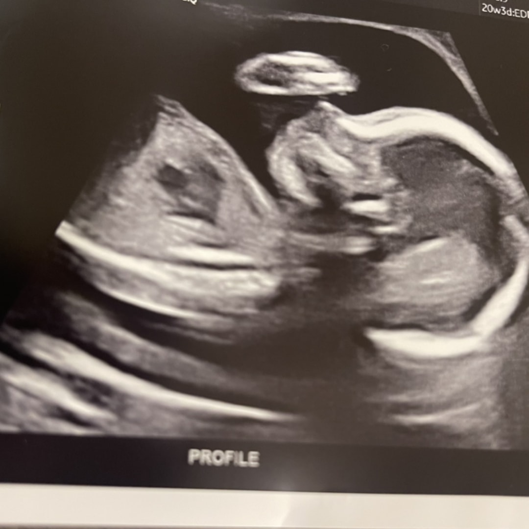 Photo shared by Anyssa for their Babylist baby registry.