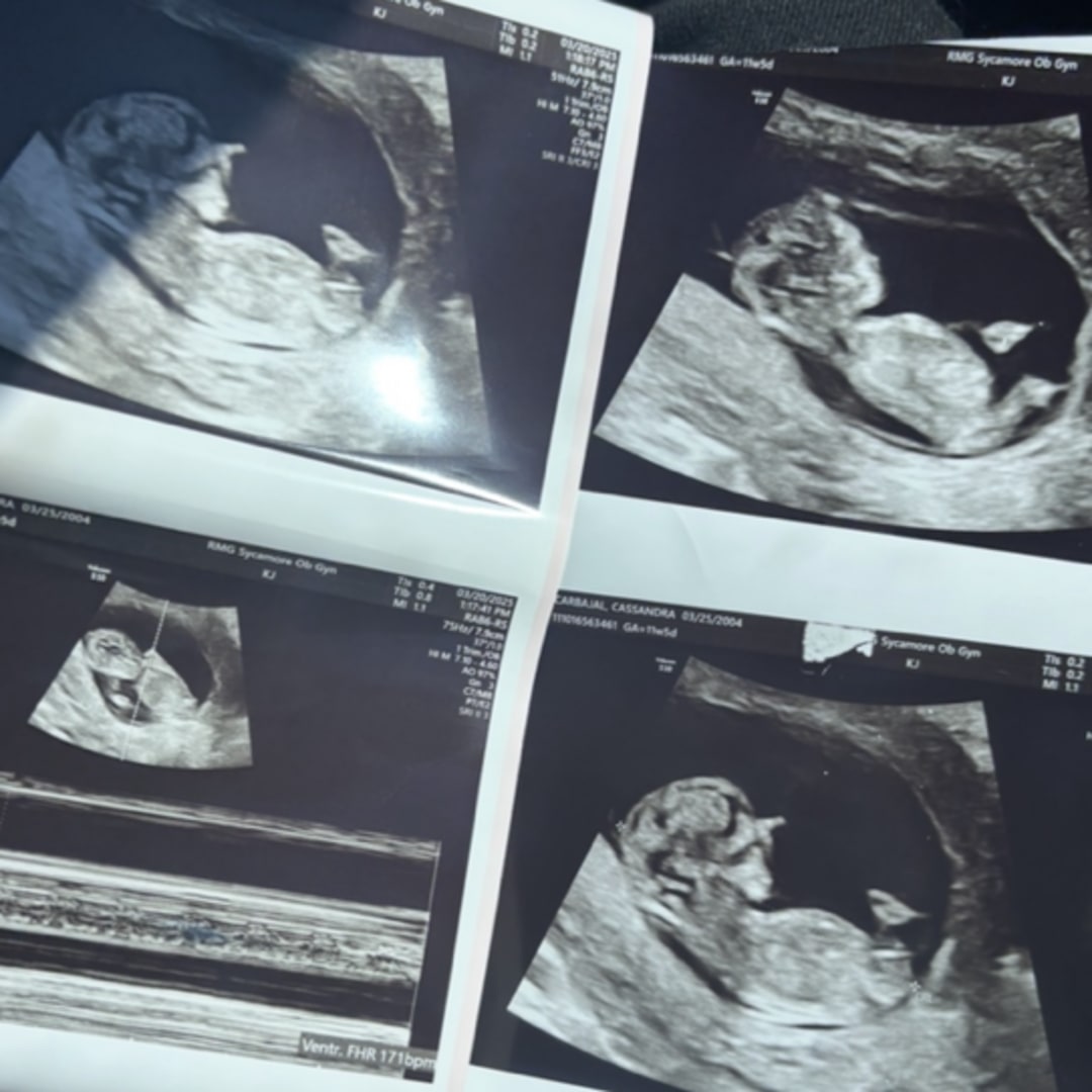 Photo shared by Cassandra for their Babylist baby registry.