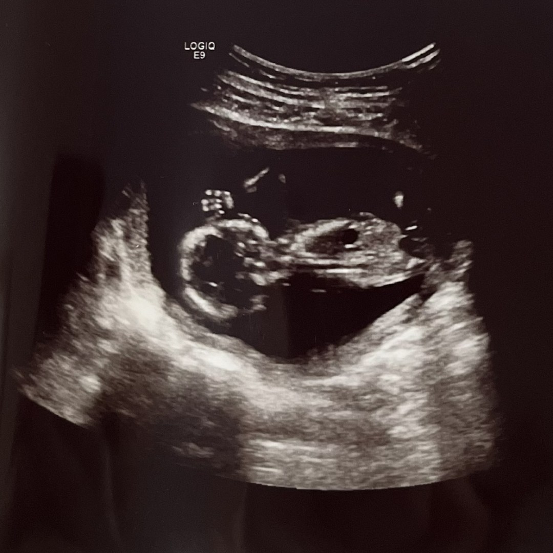 Photo shared by Kaitlyn for their Babylist baby registry.