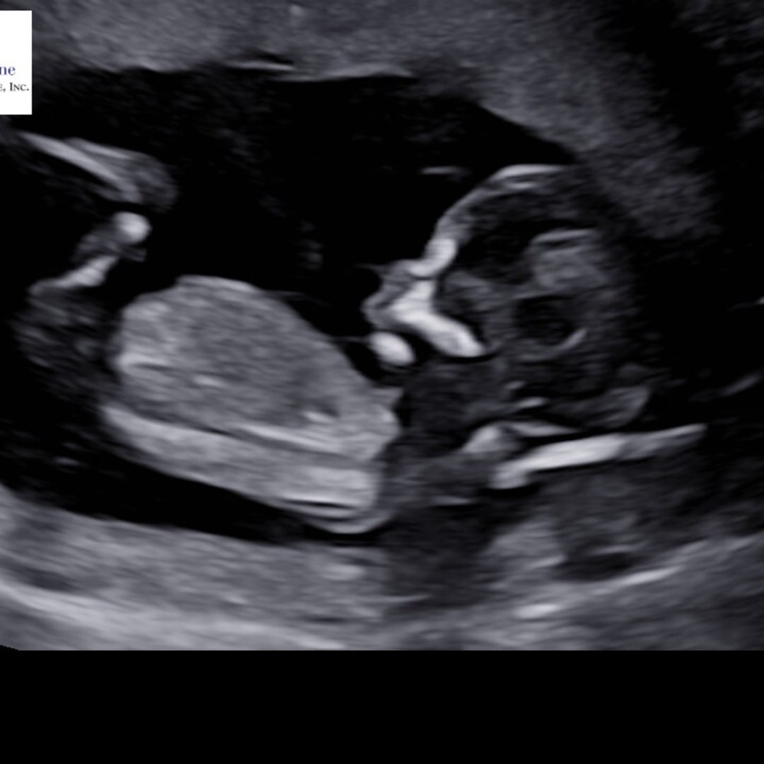 Photo shared by Jada for their Babylist baby registry.