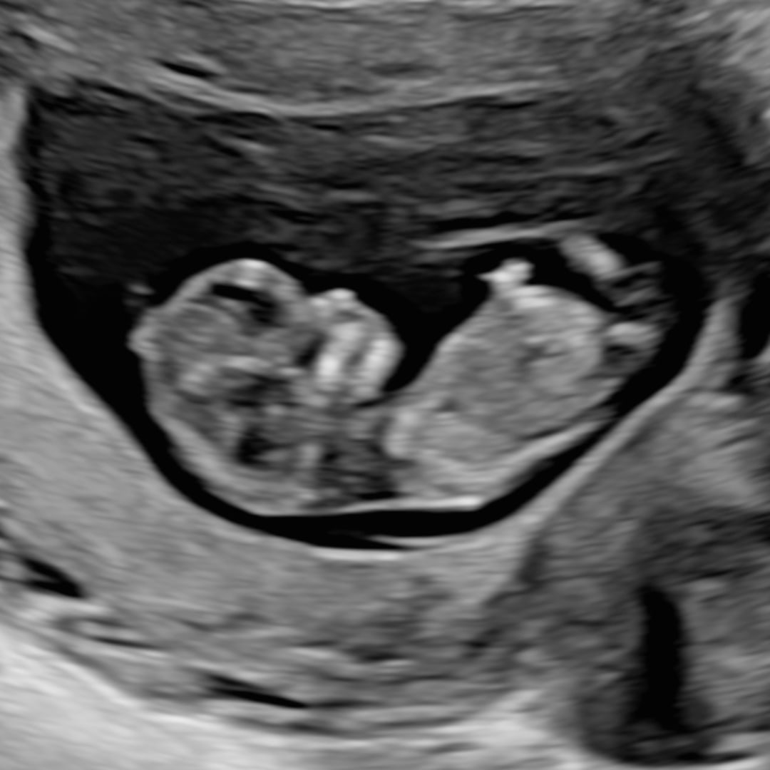 Photo shared by Belle for their Babylist baby registry.