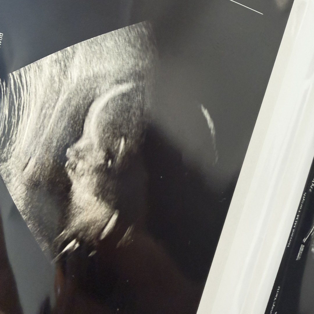 Photo shared by Anays for their Babylist baby registry.