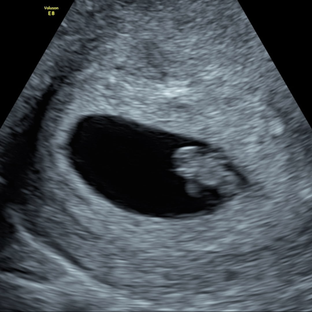 Photo shared by Anna for their Babylist baby registry.