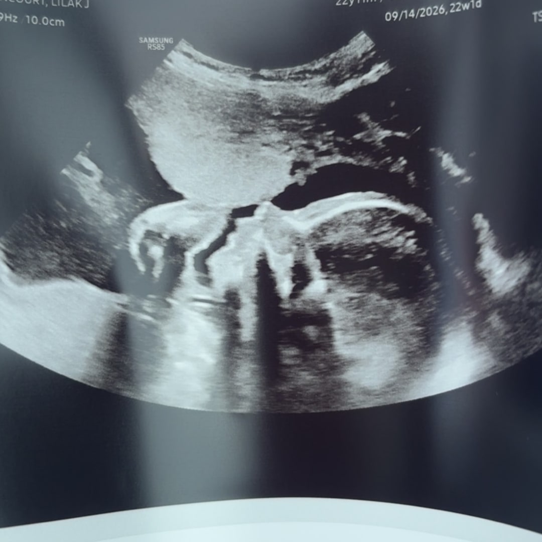 Photo shared by Lilak for their Babylist baby registry.