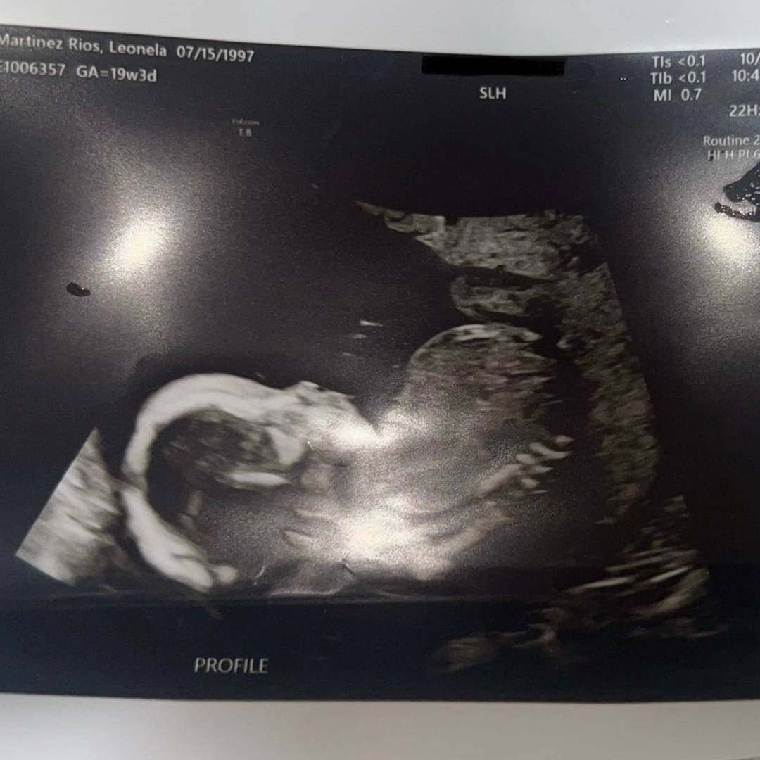 Photo shared by Leo for their Babylist baby registry.