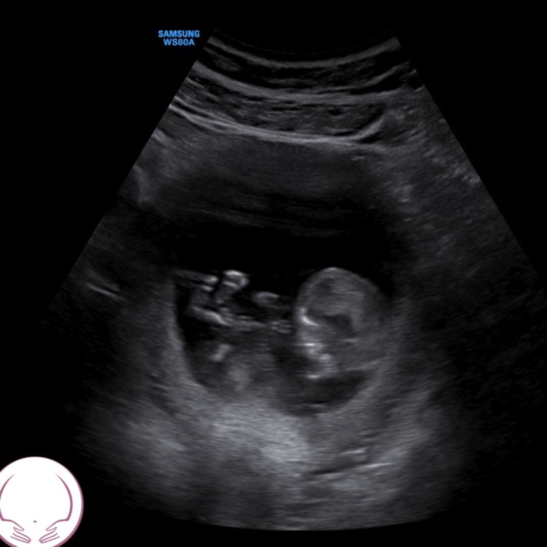 Photo shared by Emily for their Babylist baby registry.