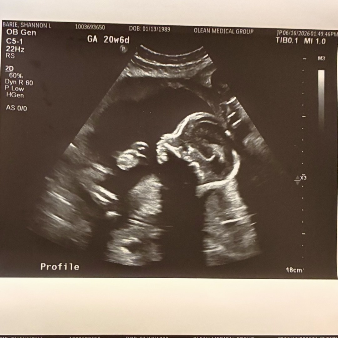 Photo shared by Shannon for their Babylist baby registry.