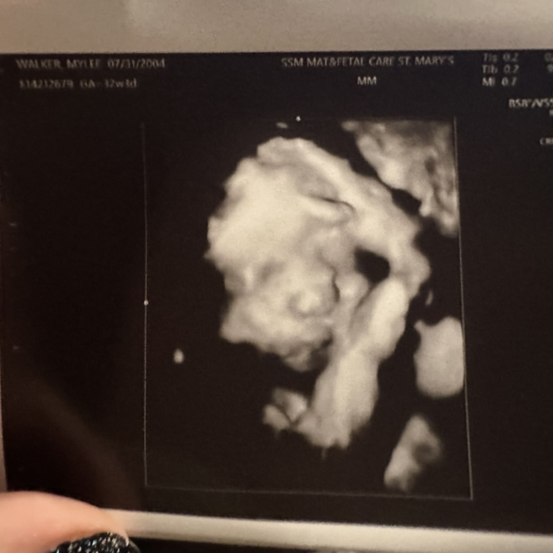 Photo shared by Mylee for their Babylist baby registry.