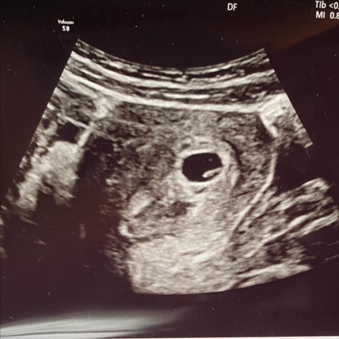 Photo shared by Haley for their Babylist baby registry.