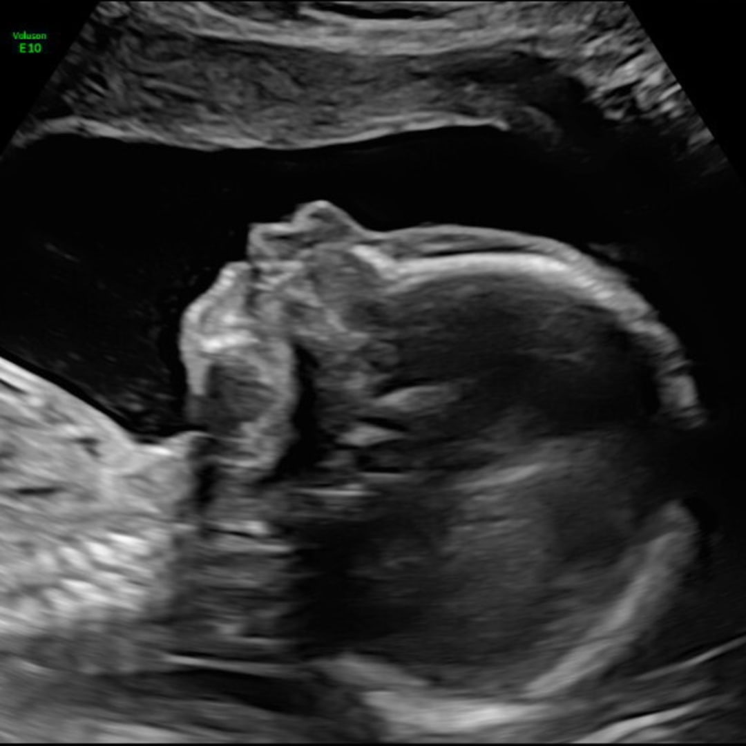 Photo shared by Alex for their Babylist baby registry.