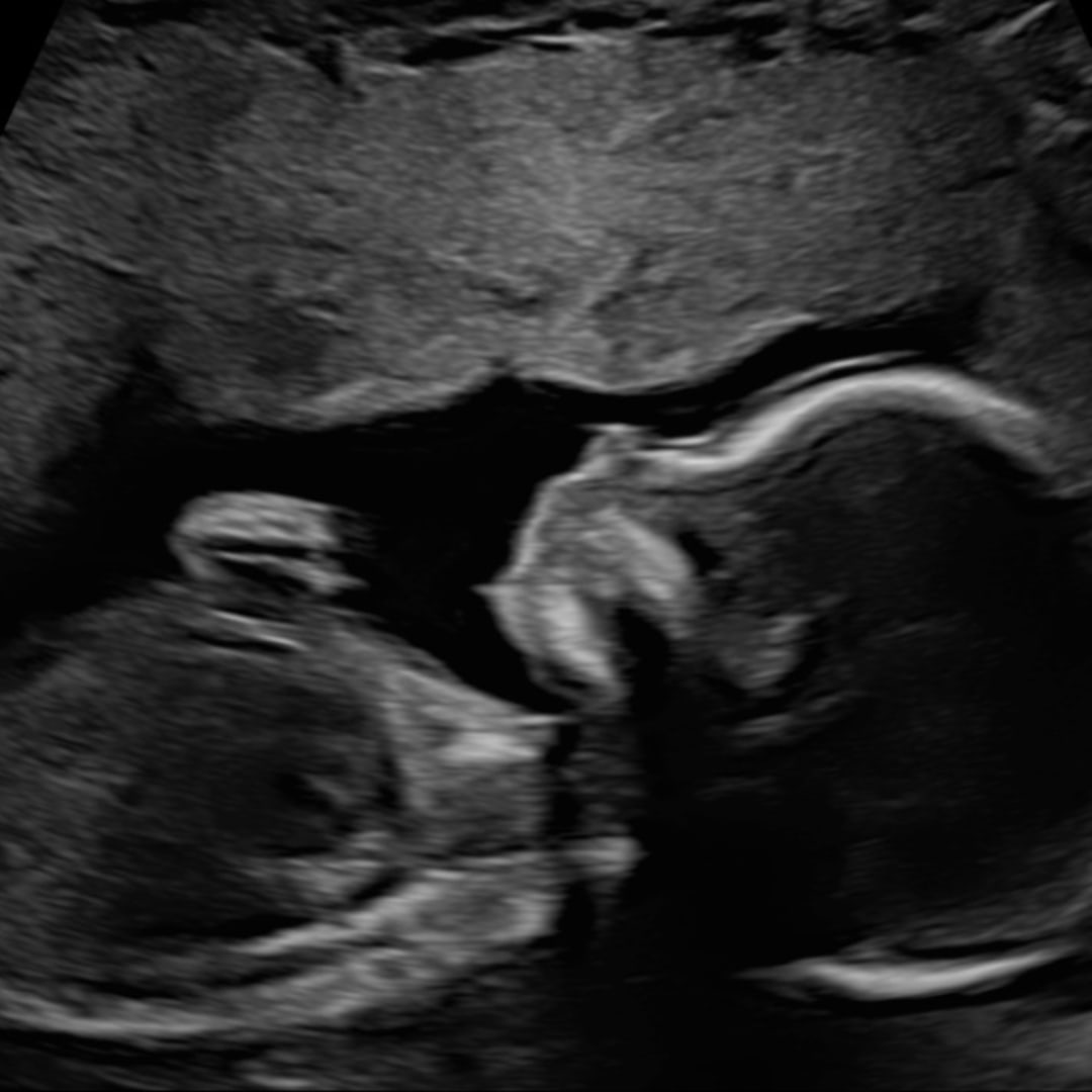 Photo shared by Hanalina for their Babylist baby registry.