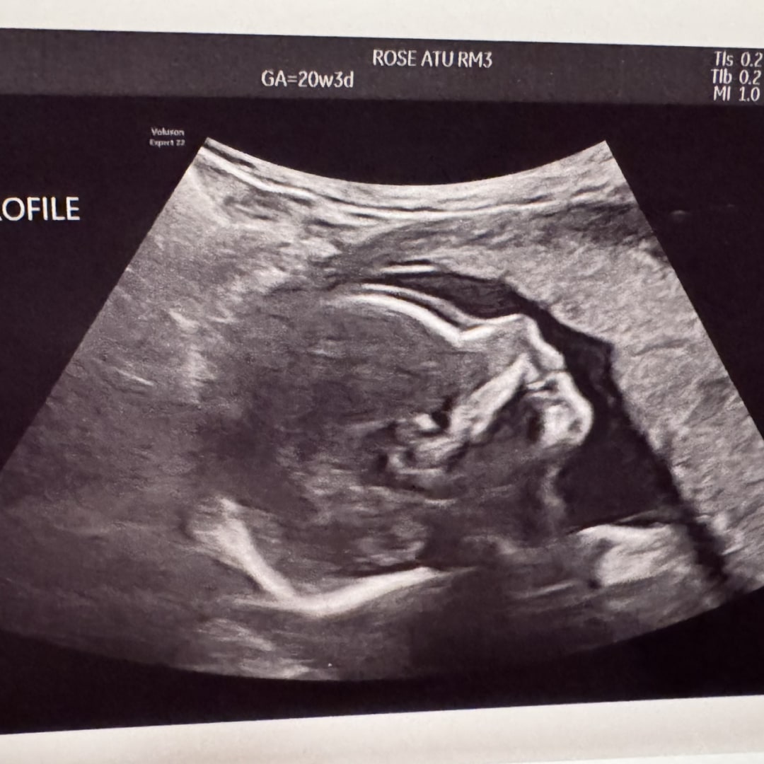 Photo shared by Bree for their Babylist baby registry.