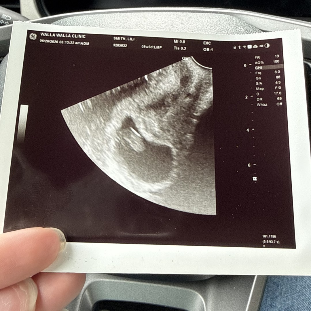 Photo shared by Lilian for their Babylist baby registry.