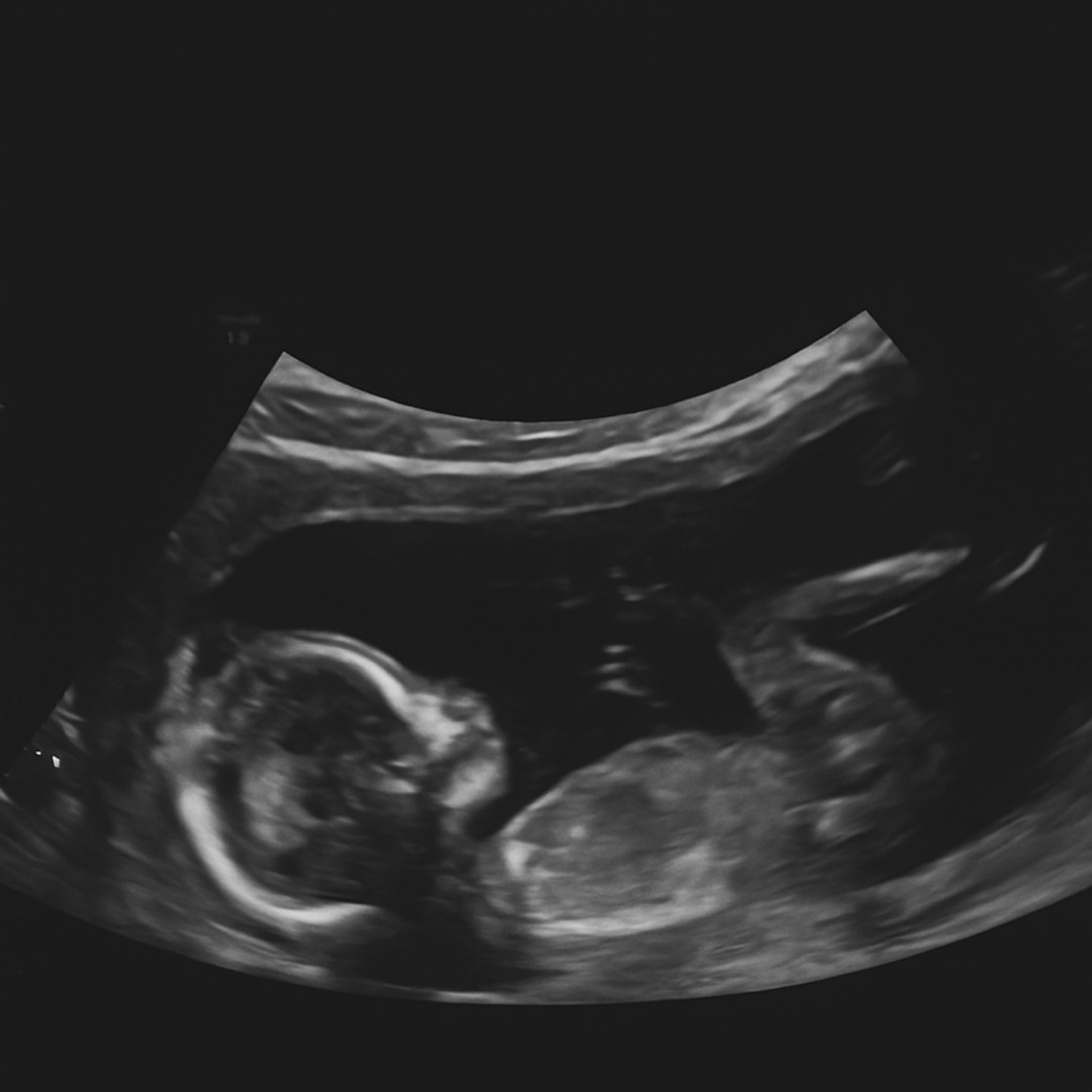 Photo shared by Arlene for their Babylist baby registry.