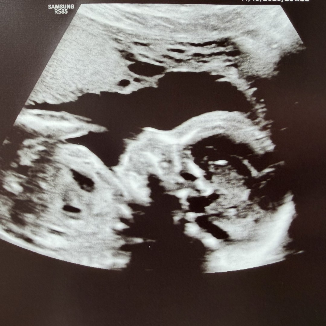 Photo shared by Carley for their Babylist baby registry.