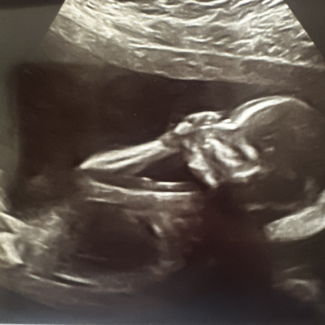Photo shared by Charline for their Babylist baby registry.