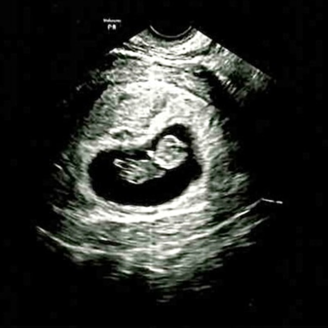 Photo shared by Erika for their Babylist baby registry.