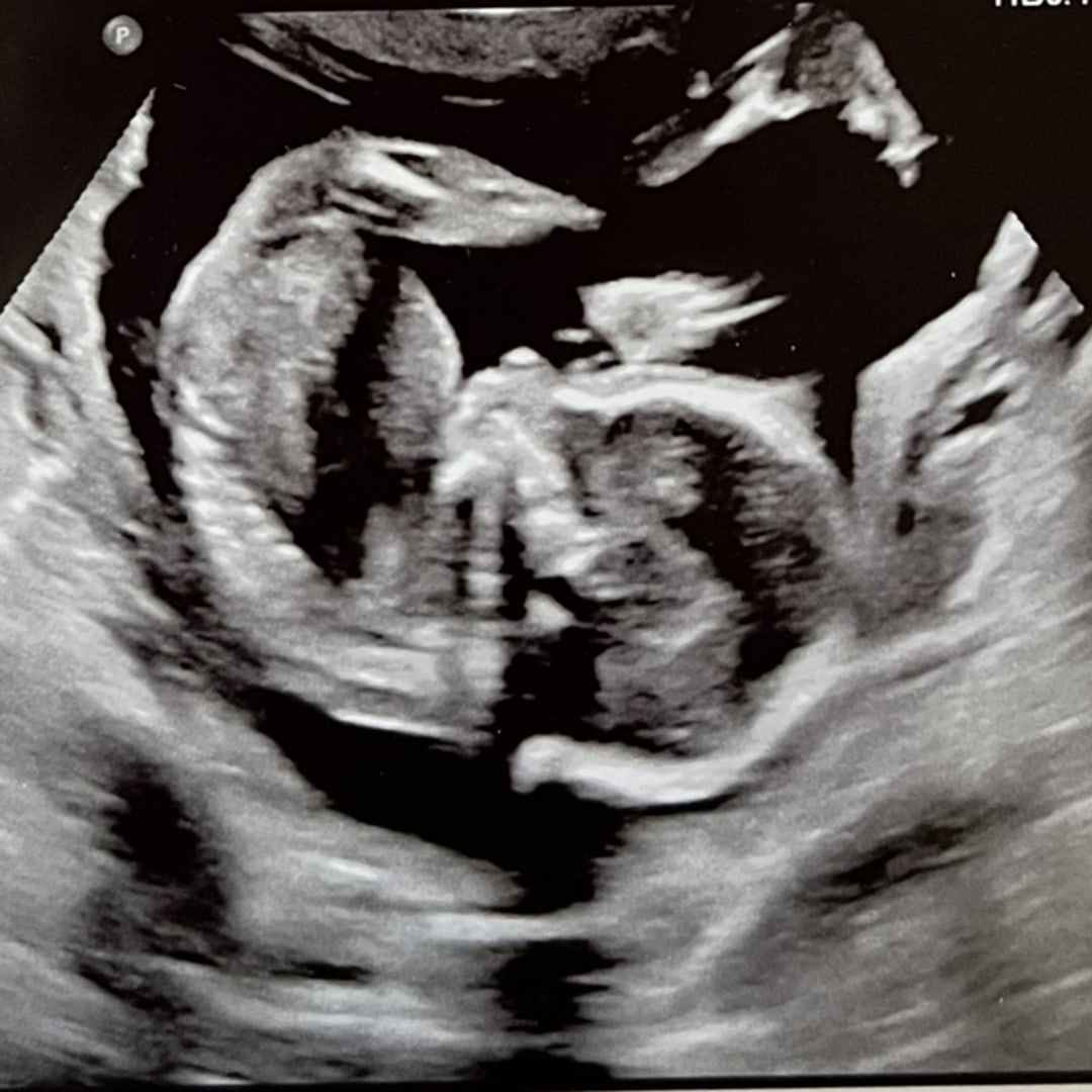 Photo shared by Annabell for their Babylist baby registry.