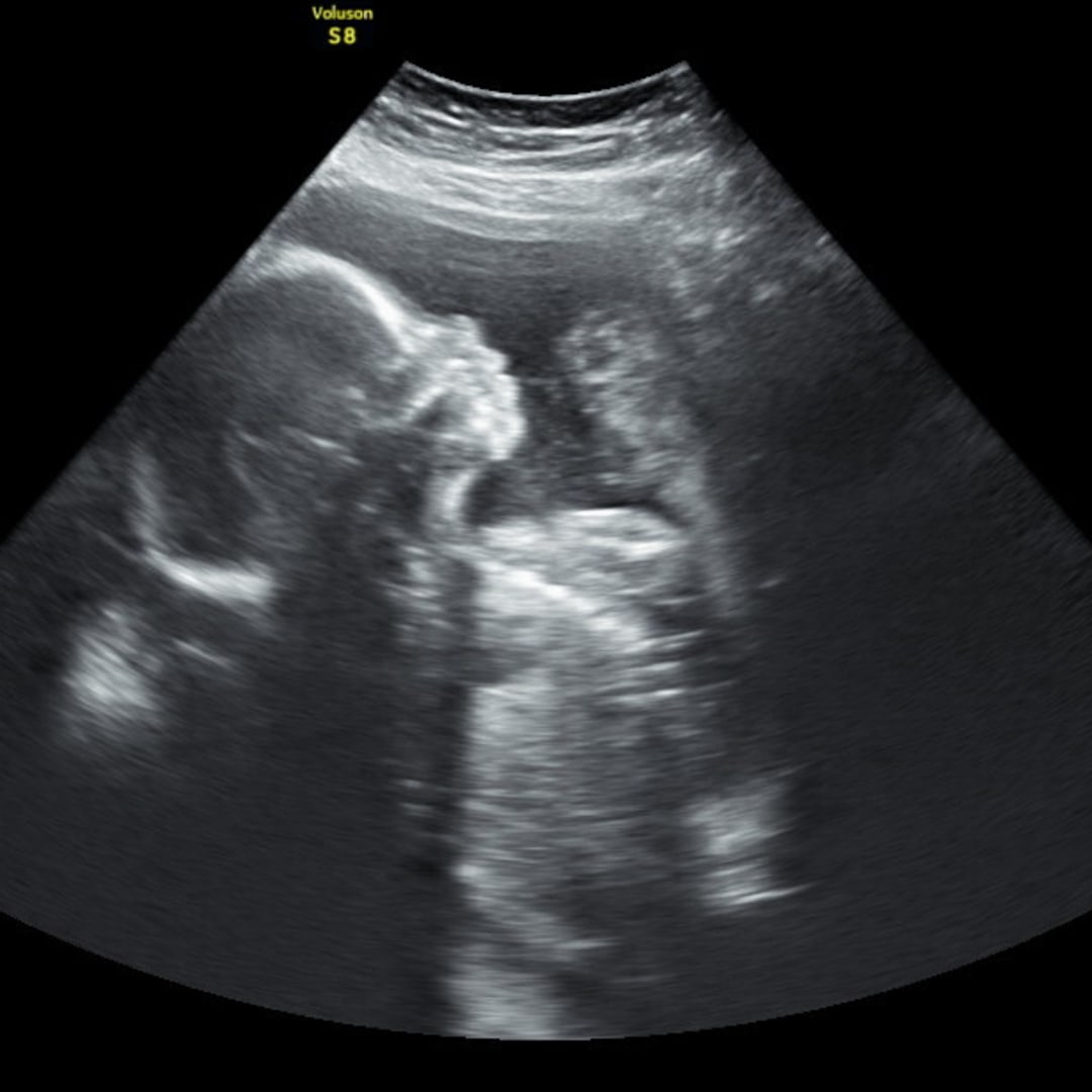 Photo shared by Lily for their Babylist baby registry.