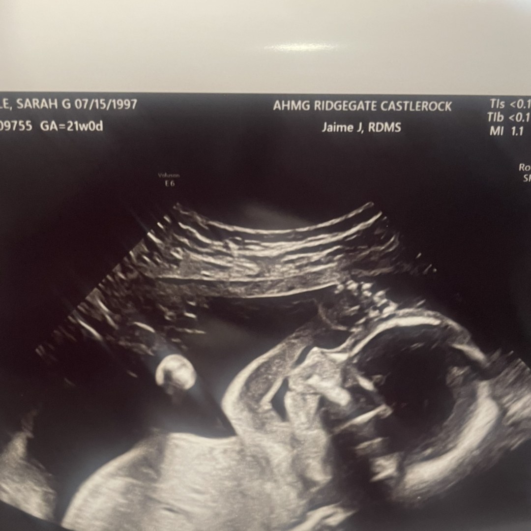 Photo shared by Sarah for their Babylist baby registry.