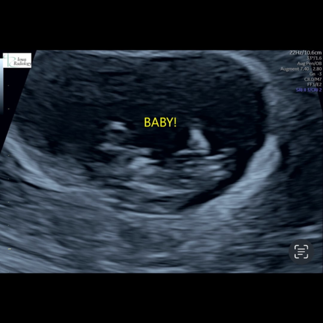 Photo shared by Hayley for their Babylist baby registry.