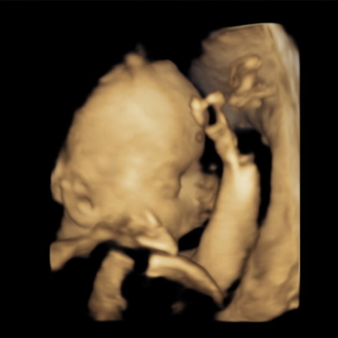 Photo shared by Alyssa for their Babylist baby registry.
