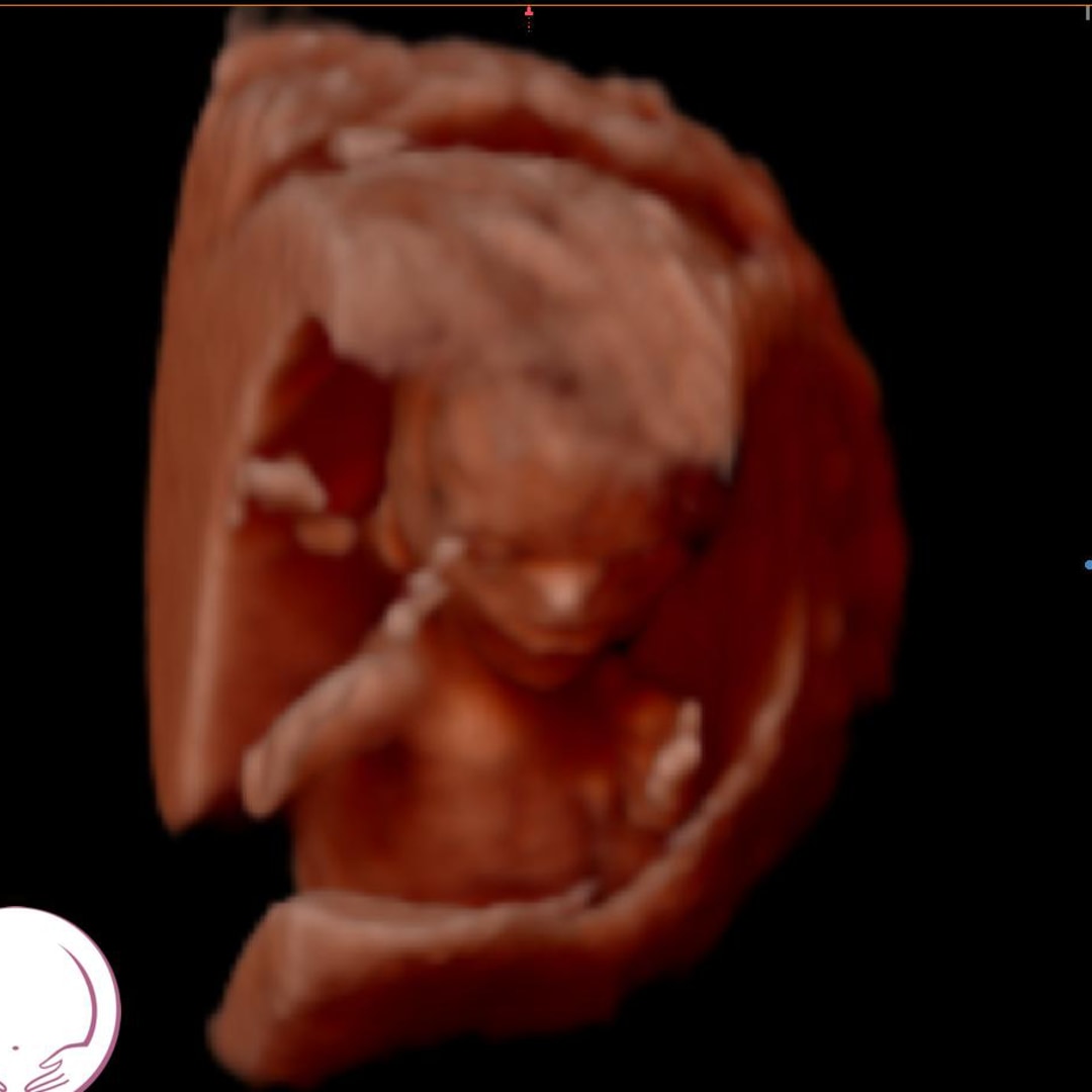 Photo shared by Hillary for their Babylist baby registry.
