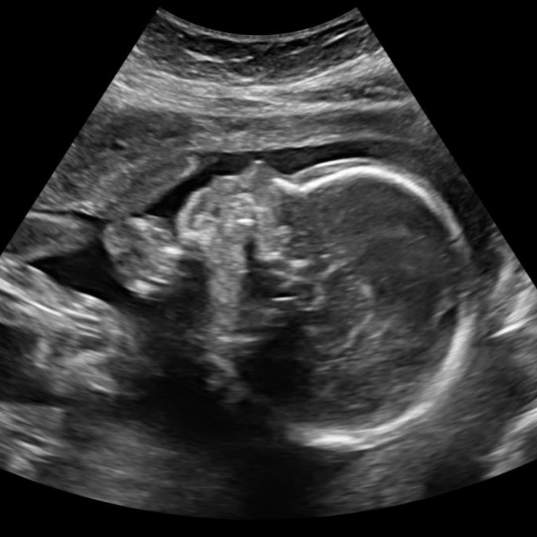 Photo shared by Amber for their Babylist baby registry.