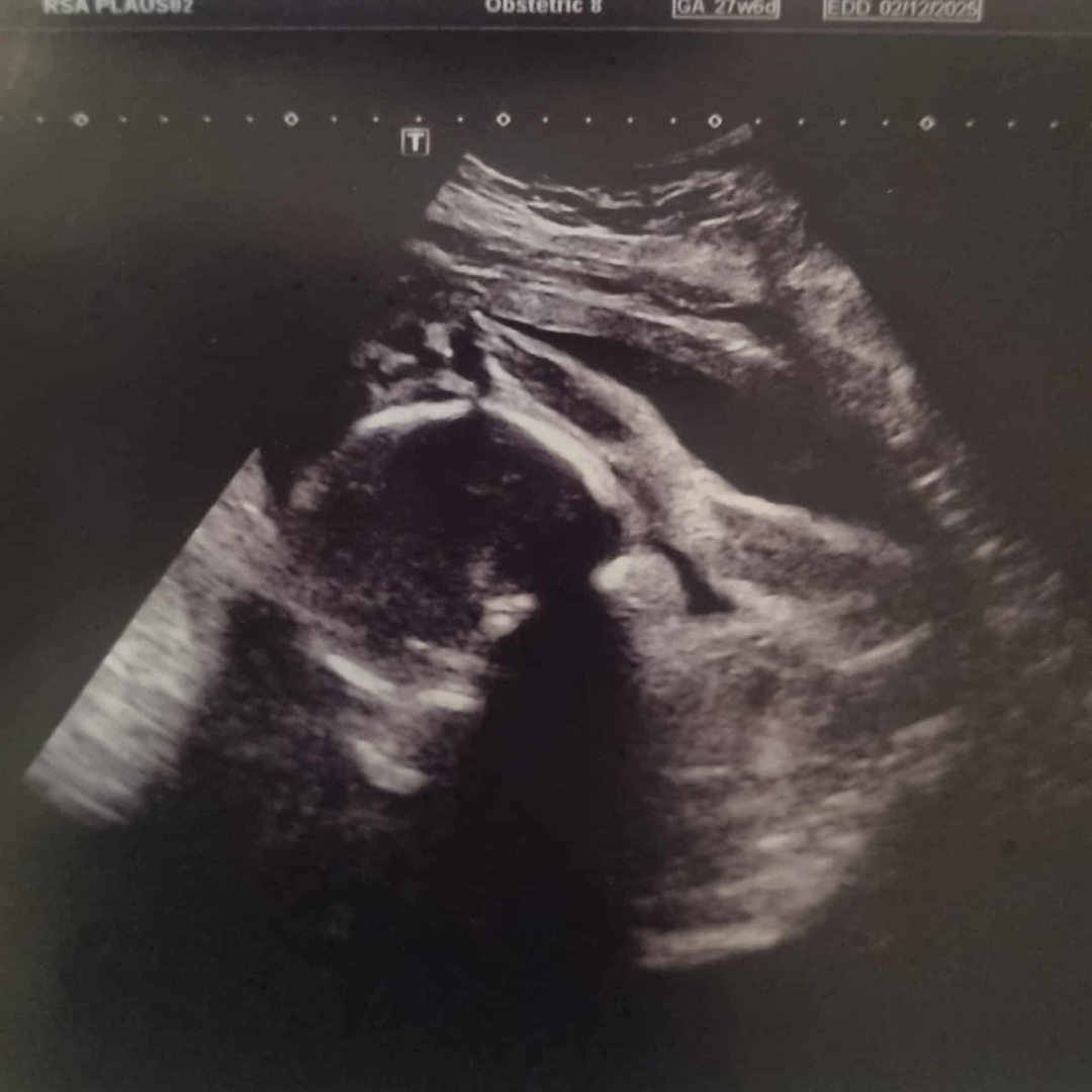 Photo shared by Jessica for their Babylist baby registry.